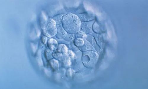 5天的囊胚好吗？三天胚胎和五天囊胚在试管婴儿技术中的区别？